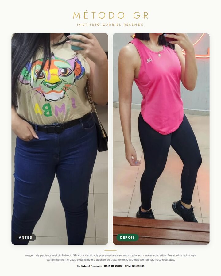 Antes e depois de paciente do Instituto (uso autorizado)