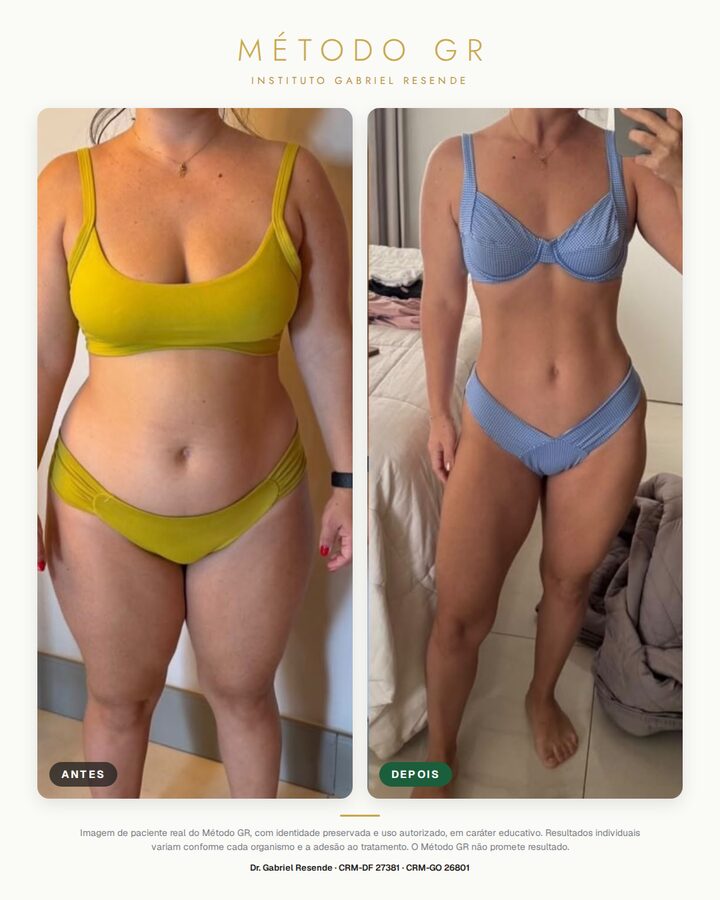 Antes e depois de paciente do Instituto (uso autorizado)