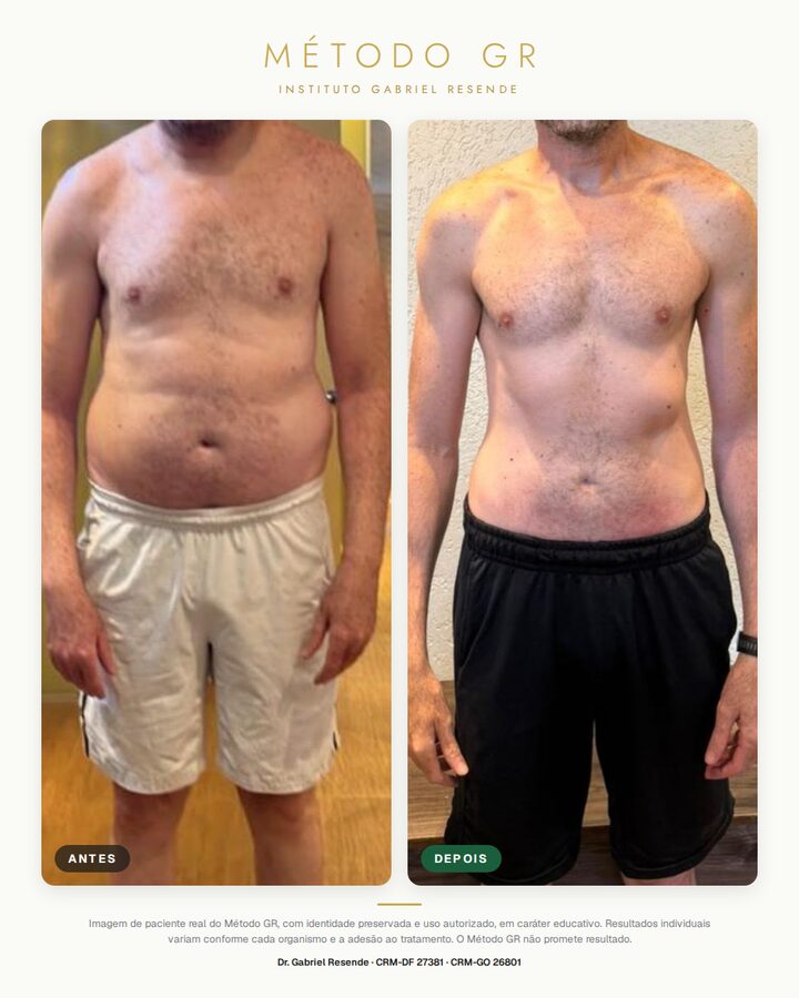 Antes e depois de paciente do Instituto (uso autorizado)